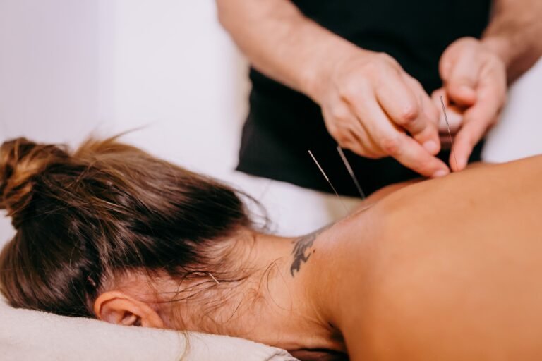 Acupunctor